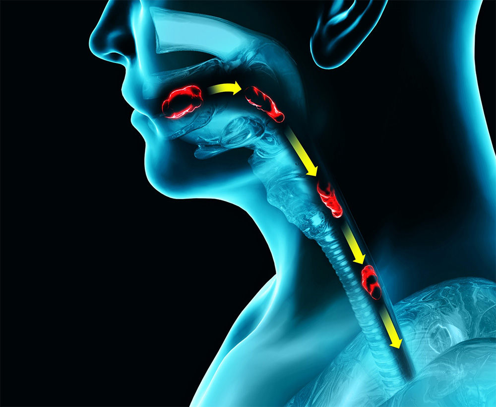 Dysphagia Assessment